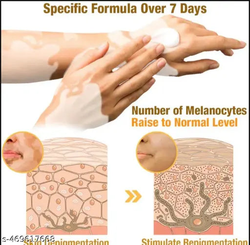 VitiGO™ Bee Venom Corrector Cream - (Buy 1 Get 1 Free🔥🔥)