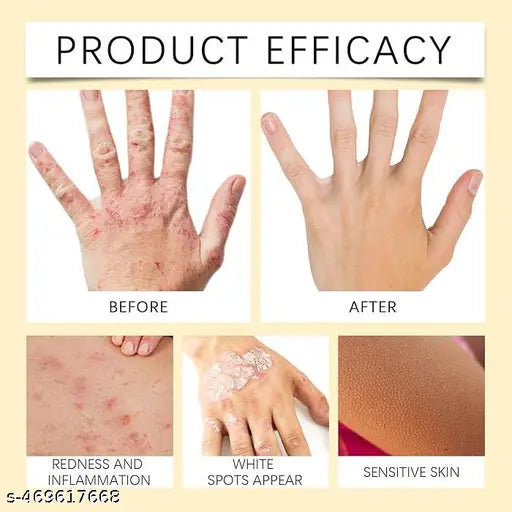 VitiGO™ Bee Venom Corrector Cream - (Buy 1 Get 1 Free🔥🔥)