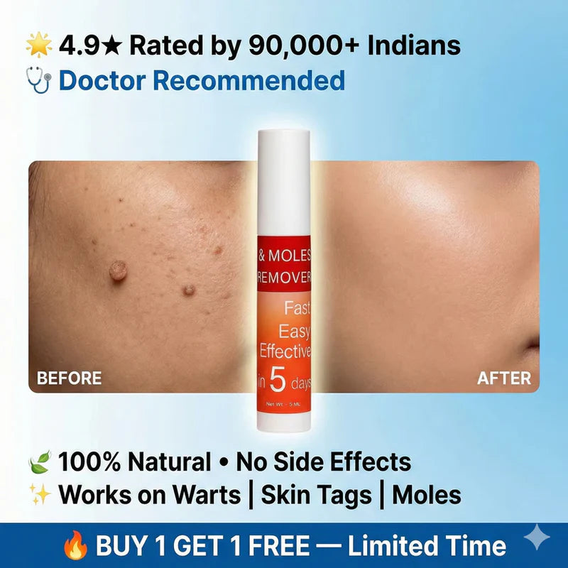LOVILDS™ Warts & Tags Remover Pen (Buy 1 Get 1 Free)